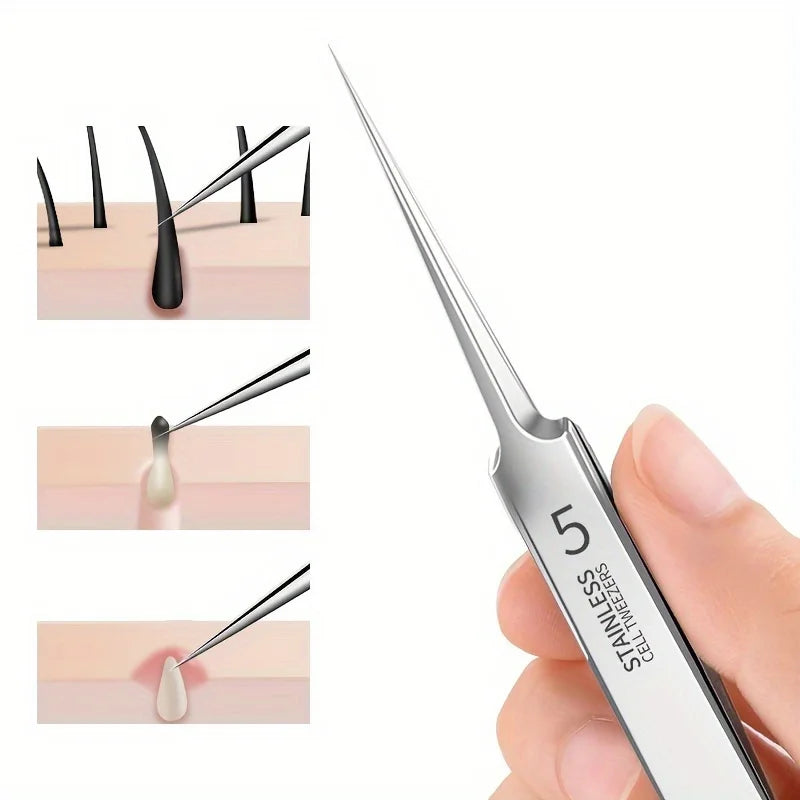 Easy-To-Use Stainless Steel Acne Extractor Set - Hypoallergenic Beauty Tweezers For Clear Skin, Perfect For Beginners